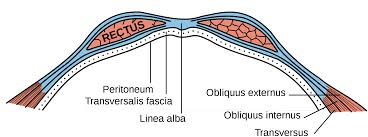 ABDOMINAL WALL